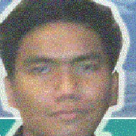 Hati-hati Terapi Sengat Lebah